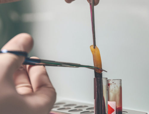 Chirurgia rigenerativa PRF