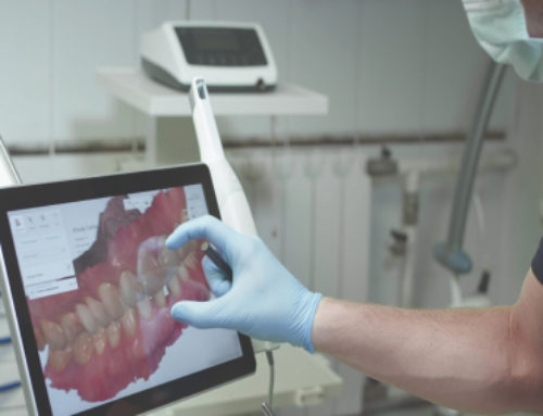 Impronta ottica con scanner