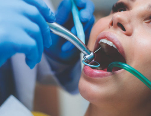 Odontoiatria conservativa