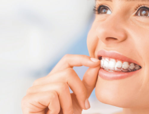 Ortodonzia invisibile INVISALIGN®