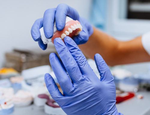 Protesi su impianti overdenture