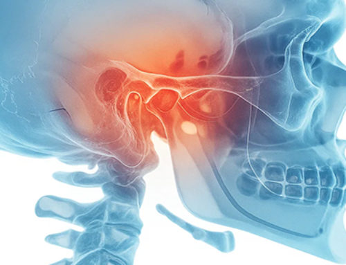 Grande rialzo del seno mascellare